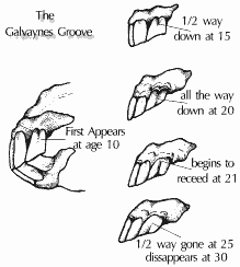 马属动物到底有几颗牙齿？